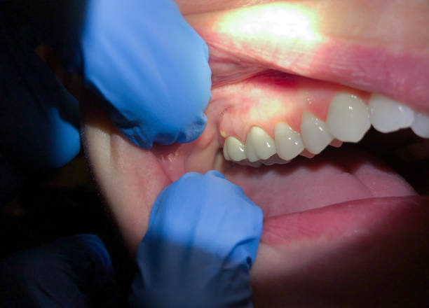 Best Urgent Care for Lost Fillings or Crowns in Salina, UT