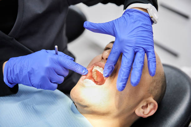 Best Emergency Tooth Extraction in Salina, UT